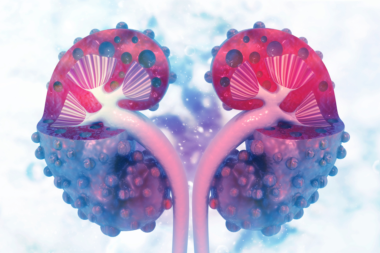 Alternative And Complementary Treatments For Polycystic Kidney Disease 