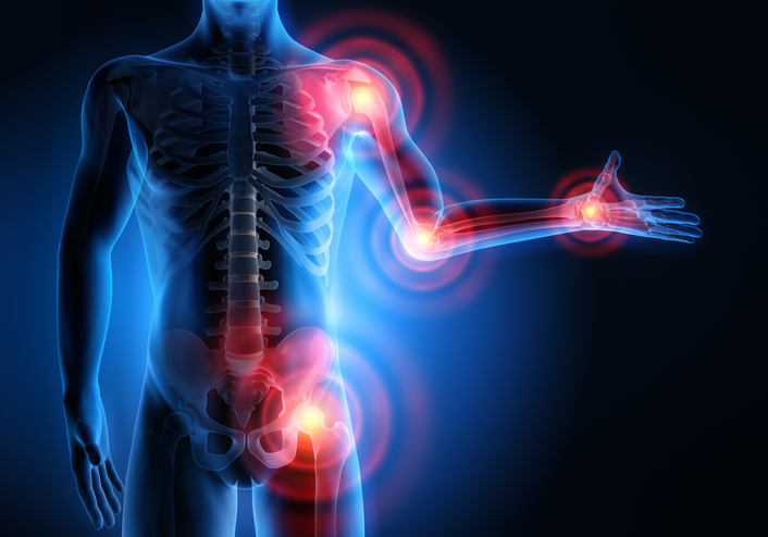 What are the Causes of Muscle Pain?, Joint Pain News