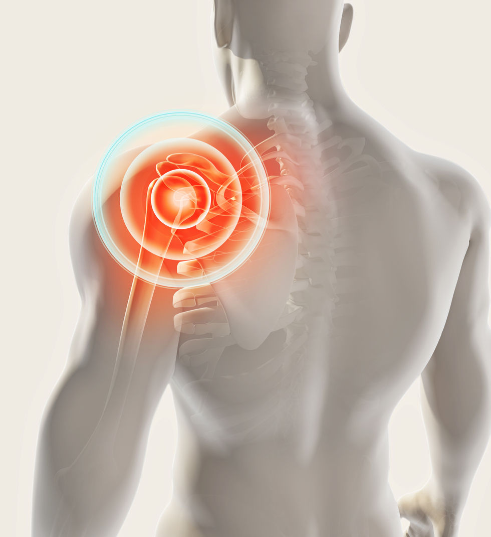 What Is Shoulder Pain?